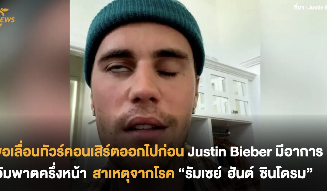 Justin Bieber มีอาการอัมพาตครึ่งหน้า สาเหตุจากโรค “รัมเซย์ ฮันต์ ซินโดรม”