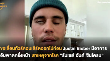 Justin Bieber มีอาการอัมพาตครึ่งหน้า สาเหตุจากโรค “รัมเซย์ ฮันต์ ซินโดรม”