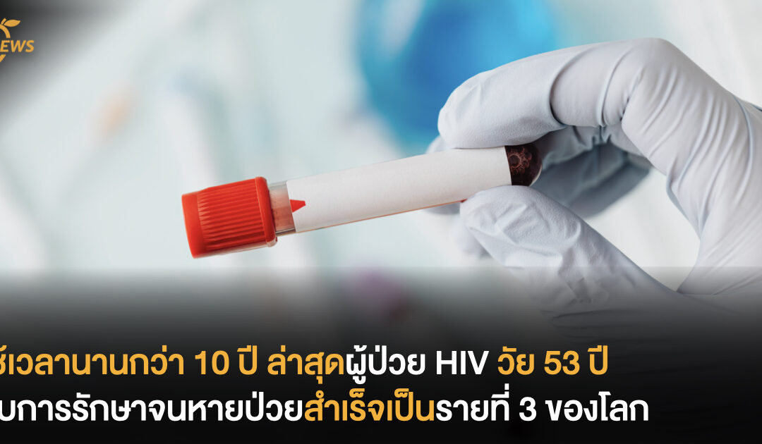 ใช้เวลานานกว่า 10 ปี ล่าสุดผู้ป่วย HIV วัย 53 ปี ถูกรักษาจนหายป่วย HIV สำเร็จเป็นรายที่ 3 ของโลก